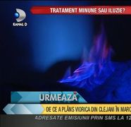 Tratamentul cu foc, minune sau iluzie? VIDEO